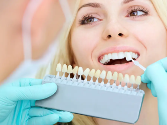 6 Benefits Of Getting Teeth Implants