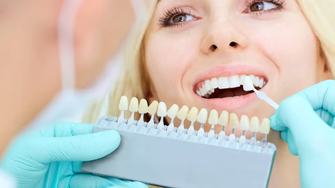 6 Benefits Of Getting Teeth Implants